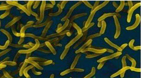 微生物菌劑好？好在哪里您知道嗎？